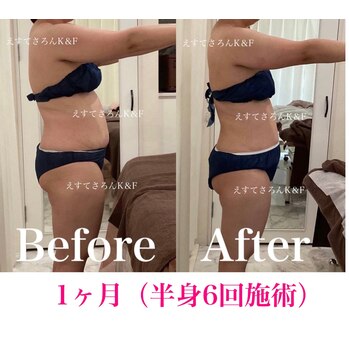 【痩身】1ヶ月でキレイ痩せ♪K&F成功ダイエット