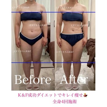 【痩身】K&F成功ダイエットでキレイ痩せ♪20代女性